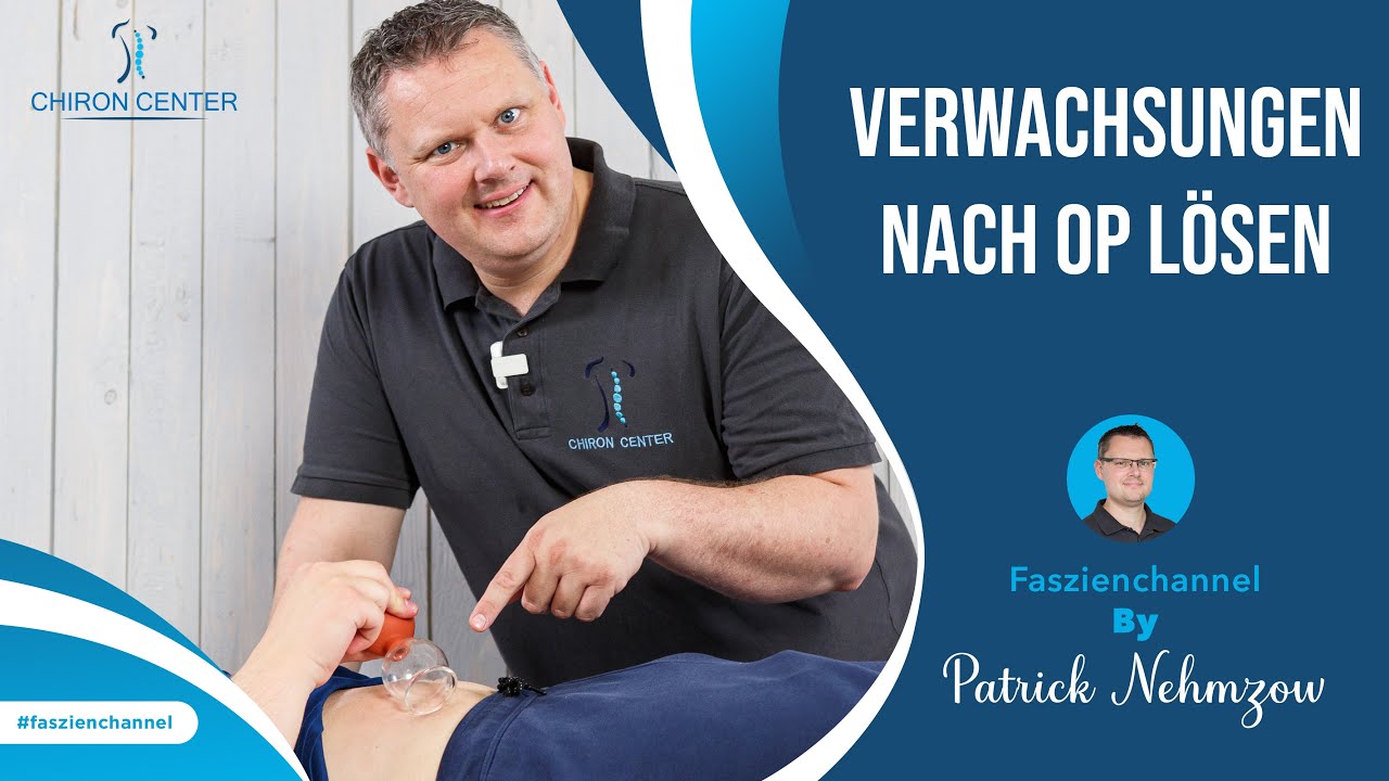 Verwachsungen nach OP lösen – Warum Du nach einer OP manchmal weniger beweglich bist