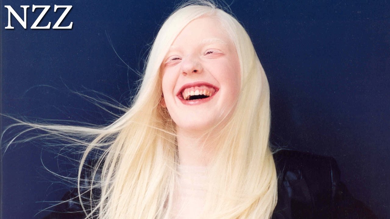 Albinos - Dokumentation von NZZ Format (2005)