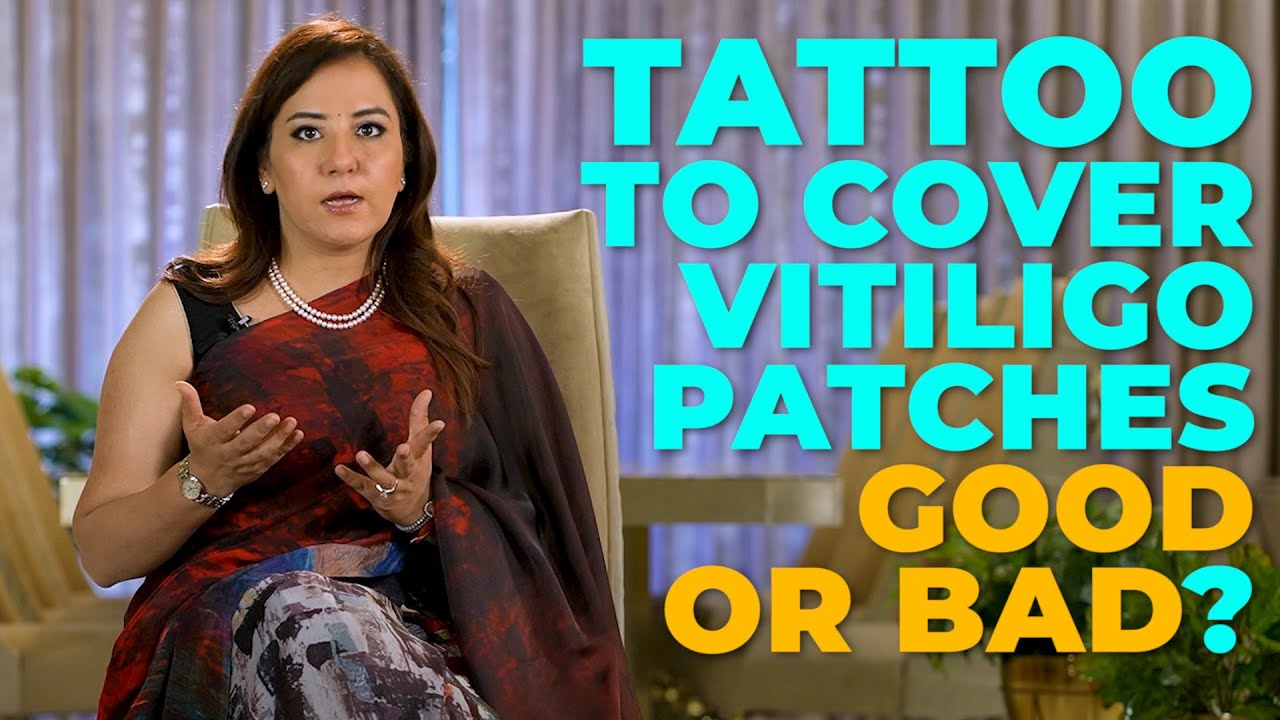 Should I Get a Tattoo to Cover My Vitiligo Patches?