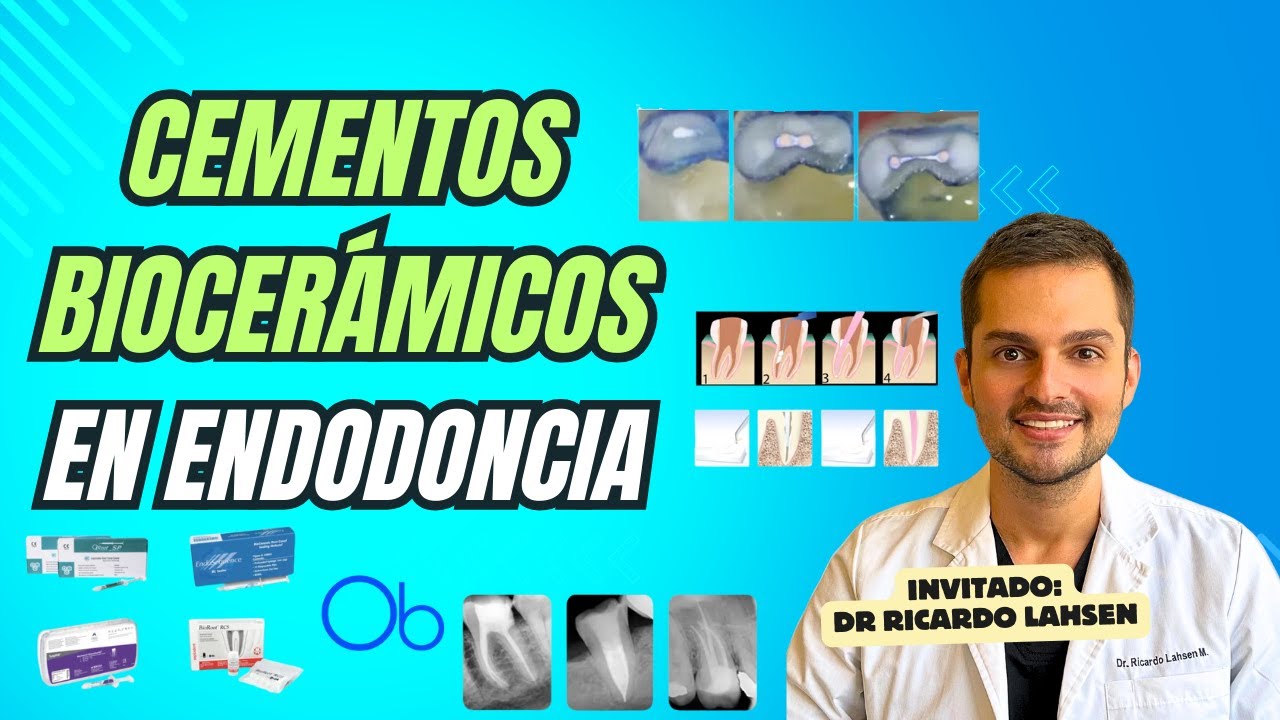 Cementos Biocerámicos en Endodoncia 🦷 con Dr Ricardo Lahsen