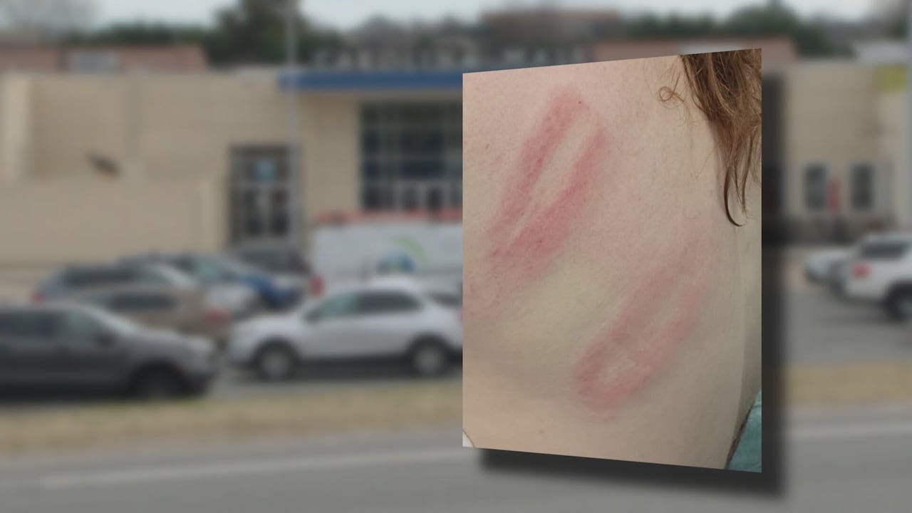 Man allegedly attacked with metal baseball bat inside Concord mall
