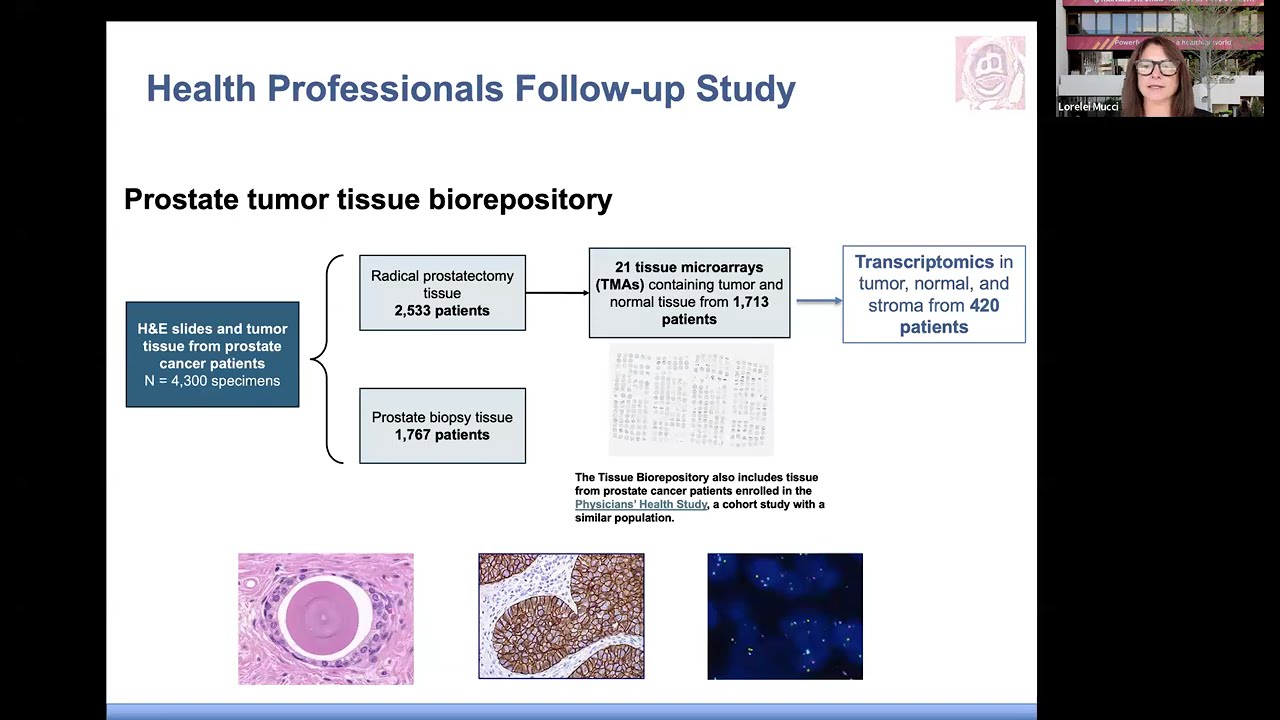 GUPS Distinguished Lecture Series Oct 9, 2025 - Prostate cancer biology and etiology