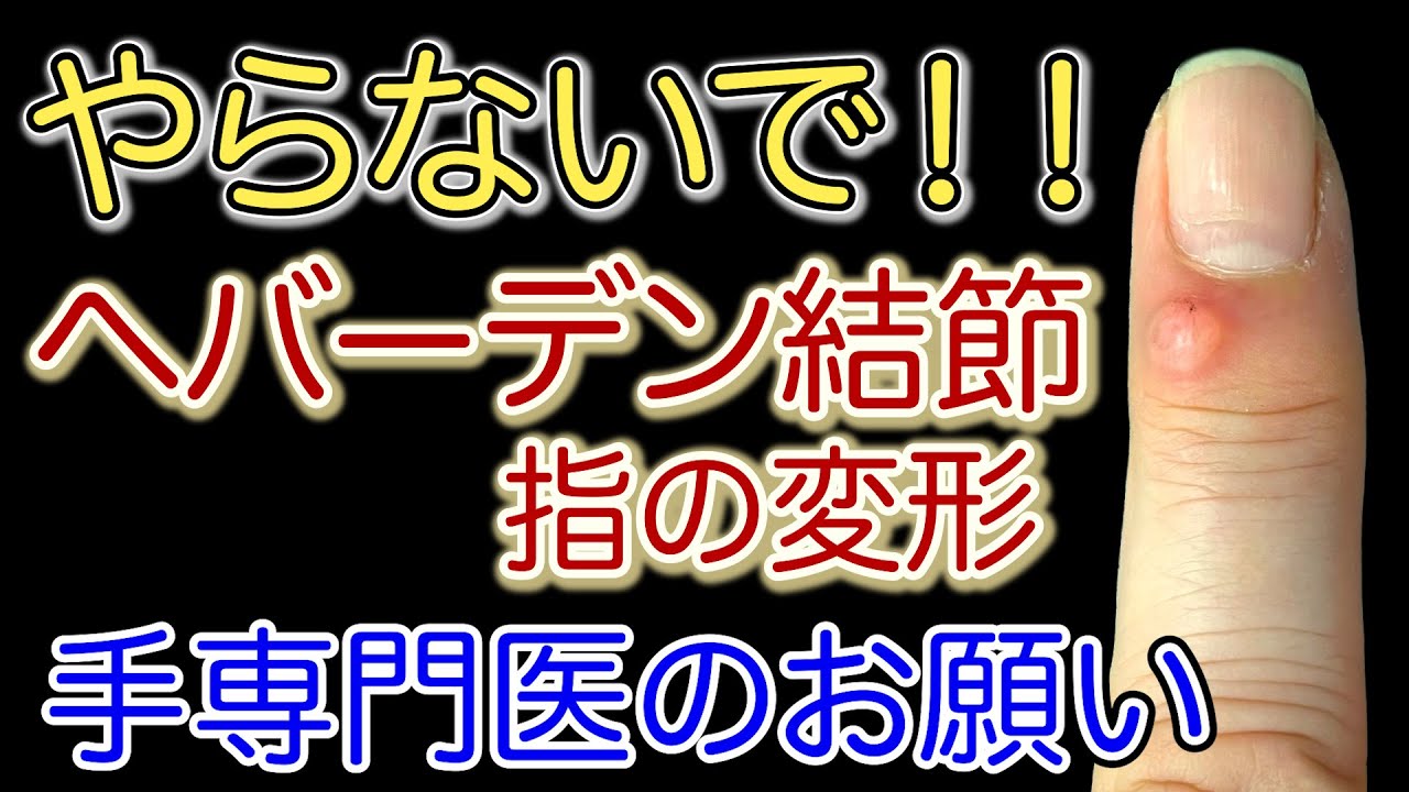 【手専門医解説】ヘバーデン結節でやってはいけない事　粘液嚢腫とは？