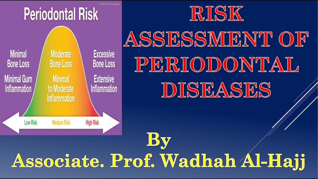 49- Risk assessment in periodontal diseases - Dr Wadhah Periodontology lectures. د/ وضاح الحاج