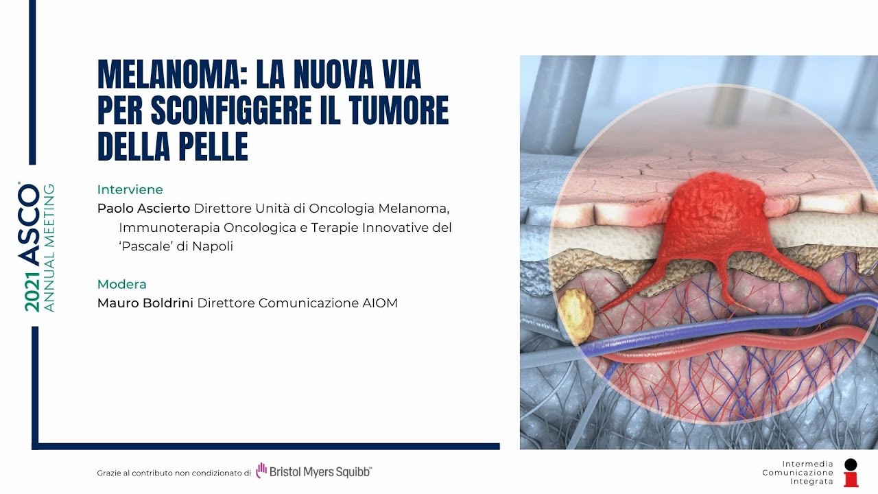 Melanoma: la nuova via per sconfiggere il tumore della pelle