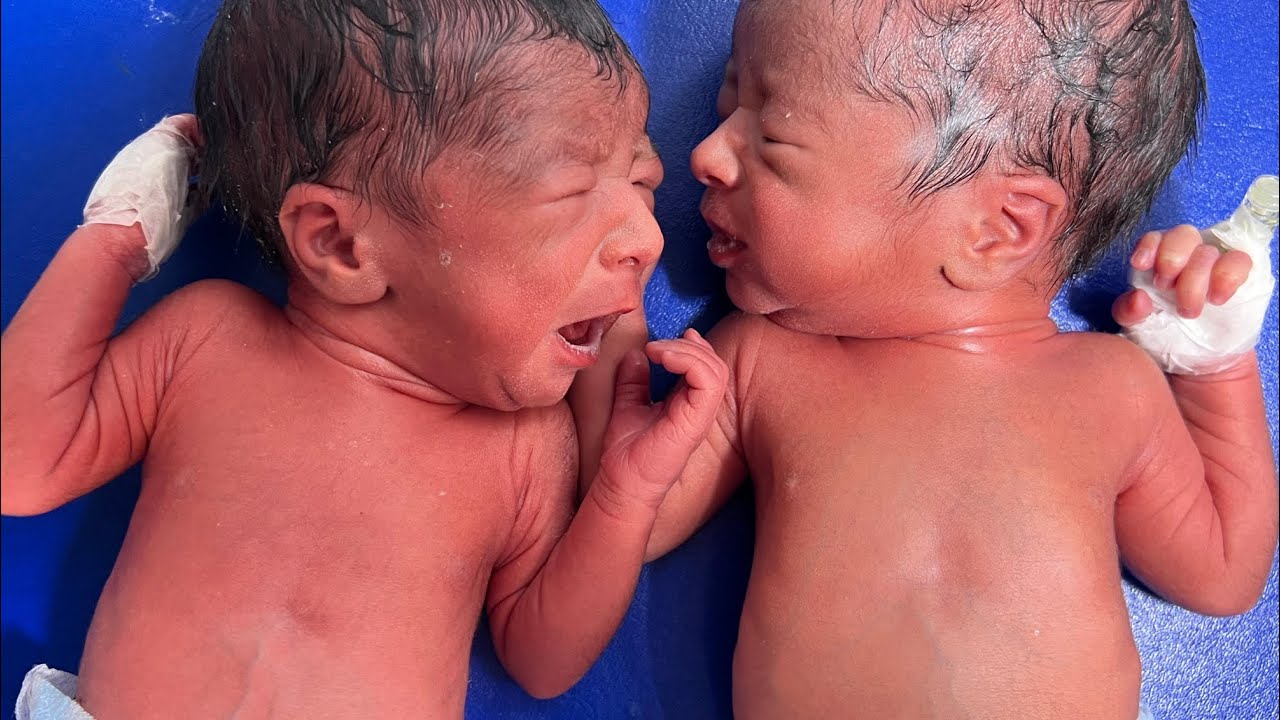From Fragile to Strong 💕 Preterm Twin Babies Now Stable
