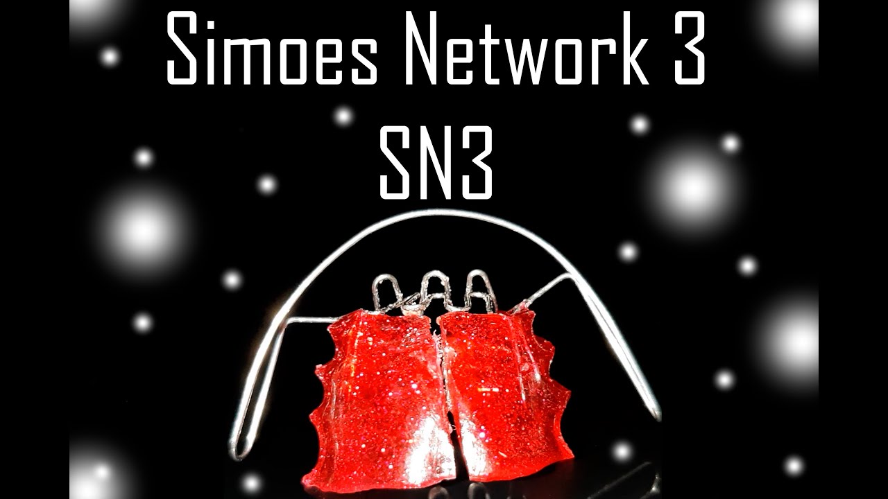 Elaboración de SN3 Simoes Network 3 | Elena Dental Art & More