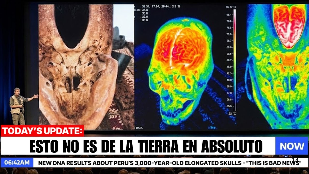 Nuevos resultados de ADN sobre los cráneos alargados de Perú — “Esto son malas noticias”