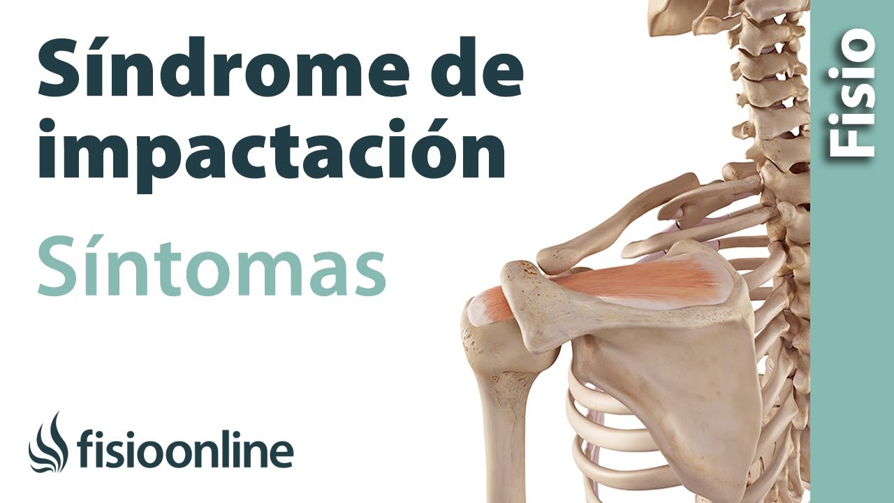 Síndrome de impactación o impingement - Qué es, causas, síntomas y tratamiento