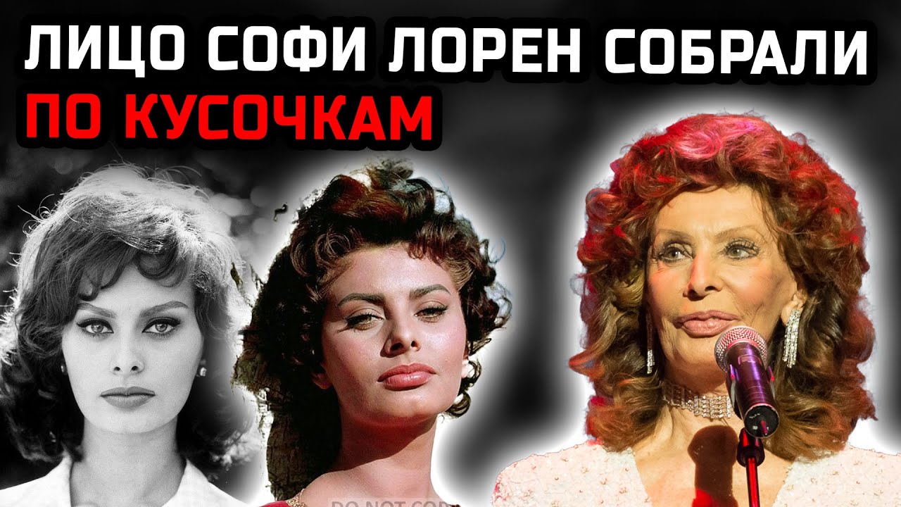 Софи Лорен: пластика сделала её звездой и пленницей