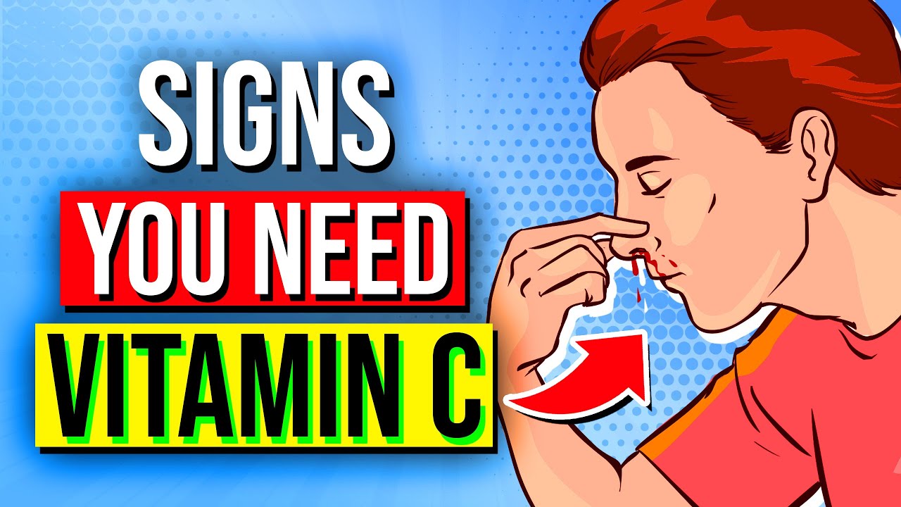 9 Alarming Signs Your Body NEEDS More Vitamin C!
