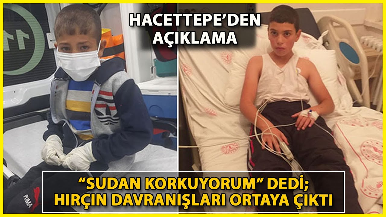 Köpek Isıran 2 Çocuktan Birine Kuduz Teşhisi