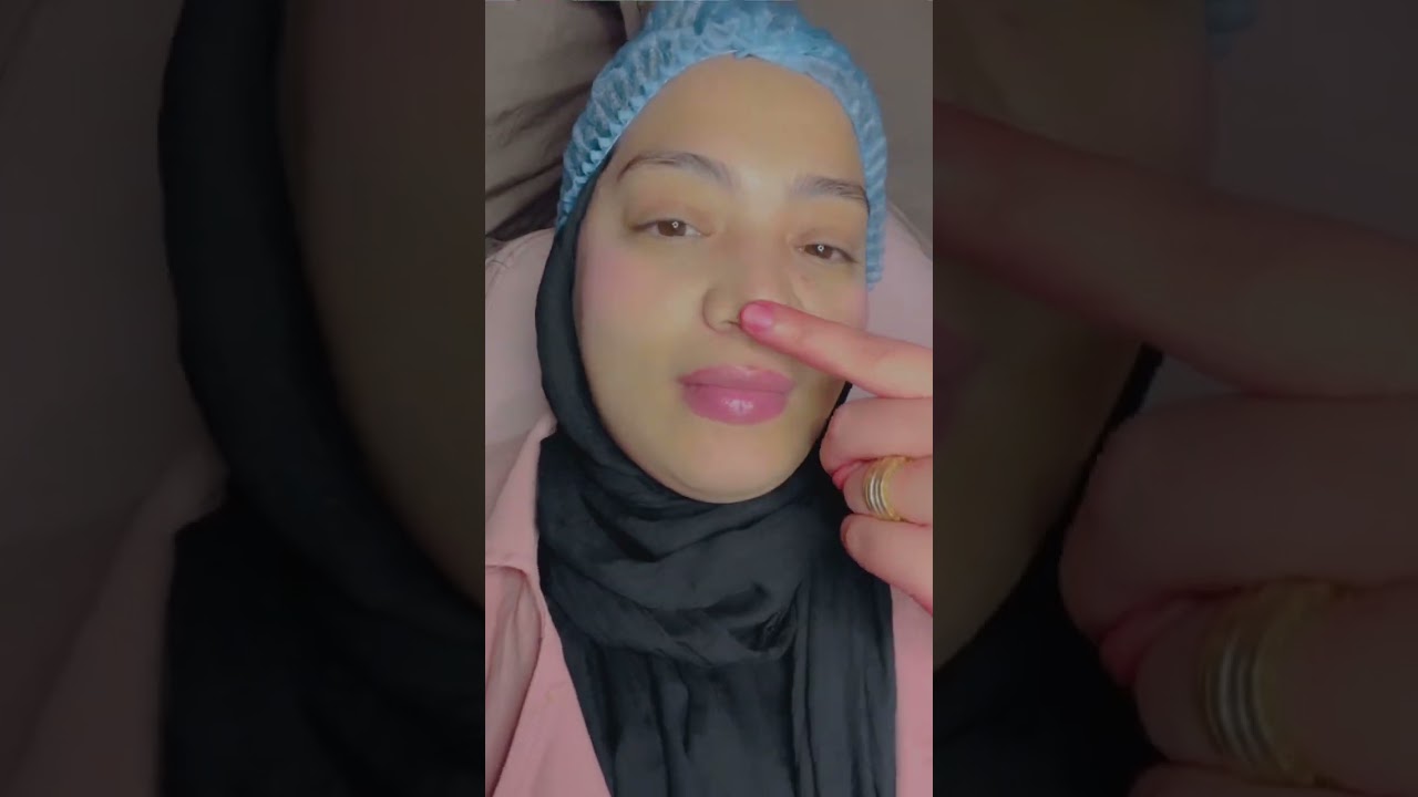 قبل العيد حبيت ادلع نفسي شوفو عملت ايه ف وشي 🙈🥰