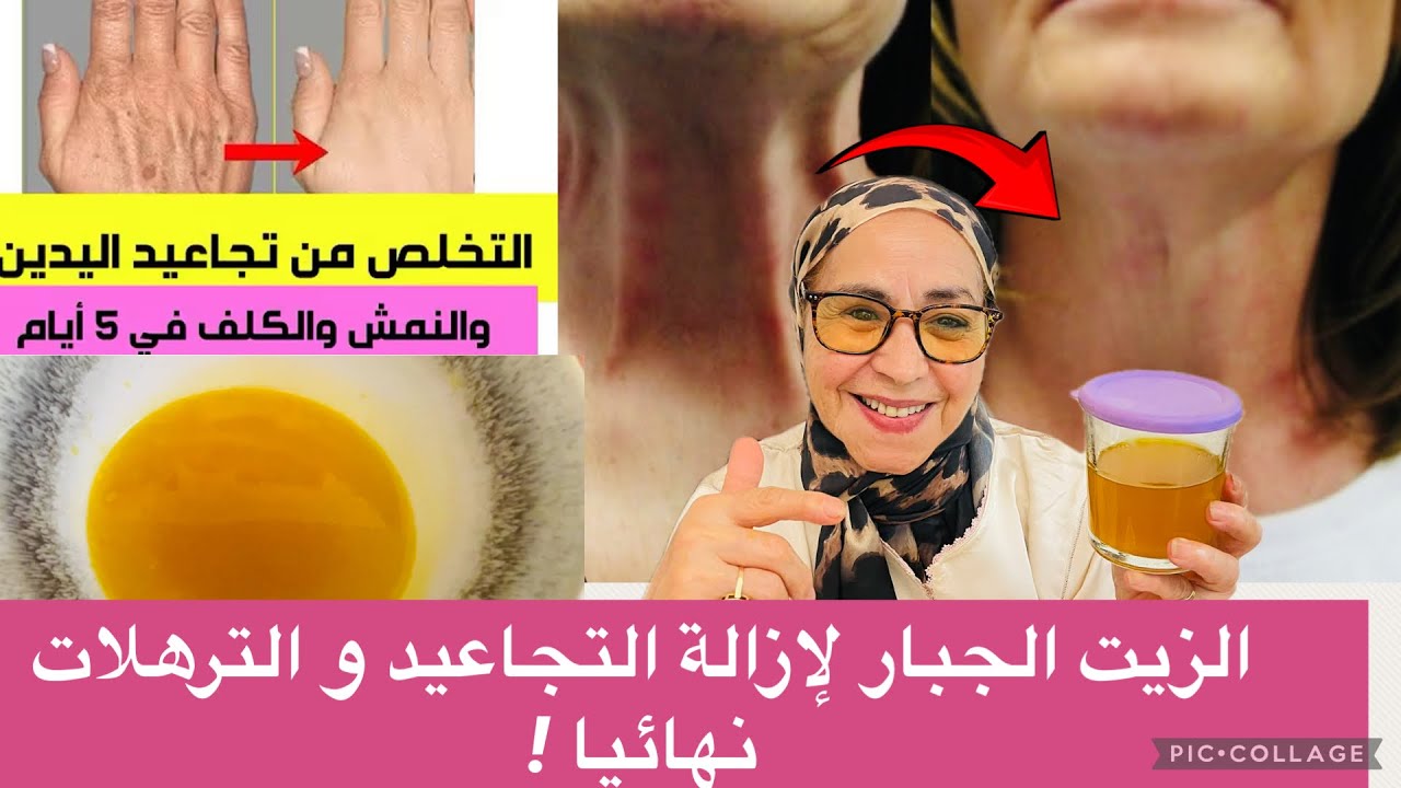 أنا مسؤولة عن كلامي ضعيه على تجاعيد و سوف تختفي نهائيا اغلى زيت في العالم اصنعيه بنفسك