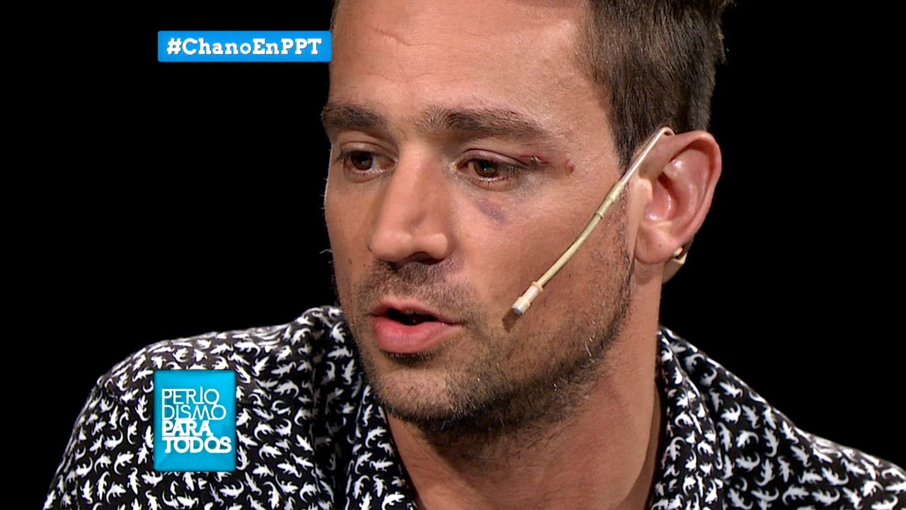 Chano con Lanata: 