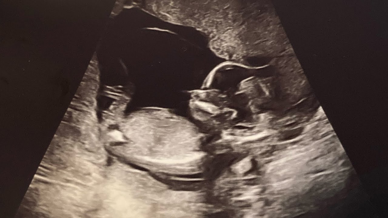 BABY FICK REACTION2