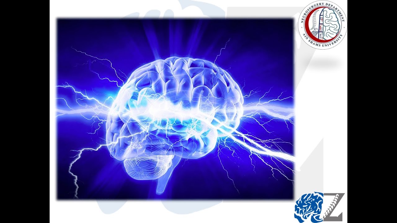 Seizures (1)   الصرع