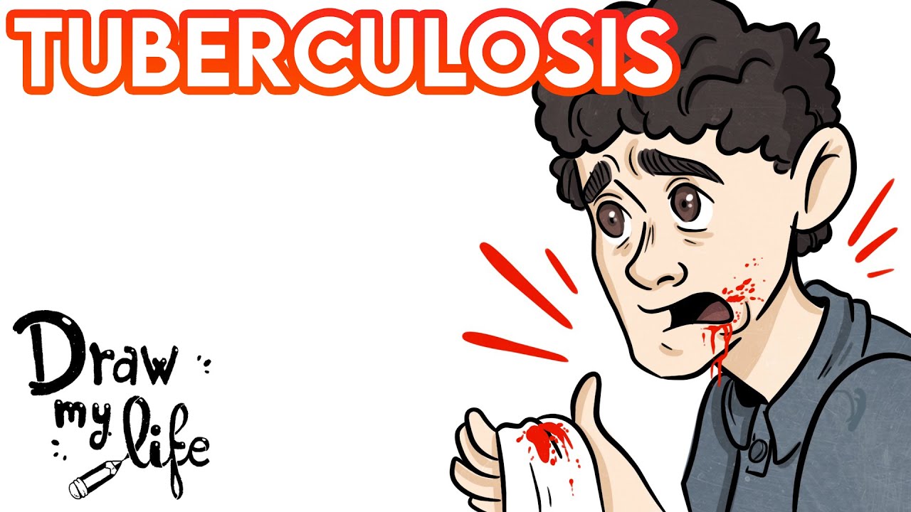 ¿QUÉ ES LA TUBERCULOSIS? - ENFERMEDAD y SÍNTOMAS | Draw My Life en Español