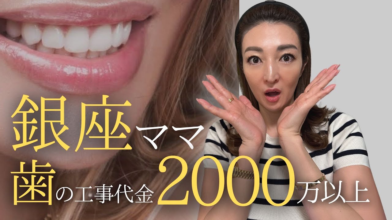 銀座のママ歯の治療費２０００万以上！銀座のお話。美の話💄