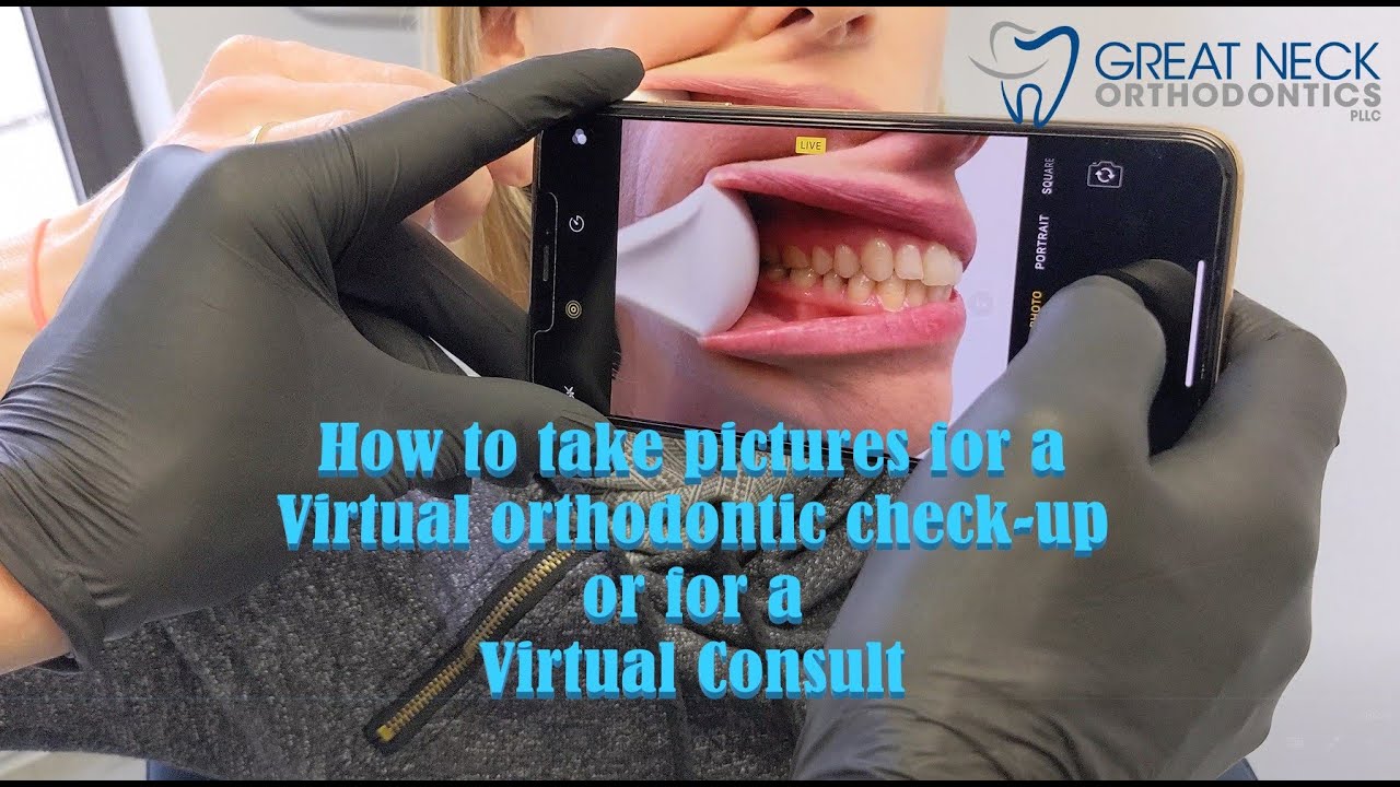 How to take pictures for a virtual orthodontic check-up or virtual consultation!
