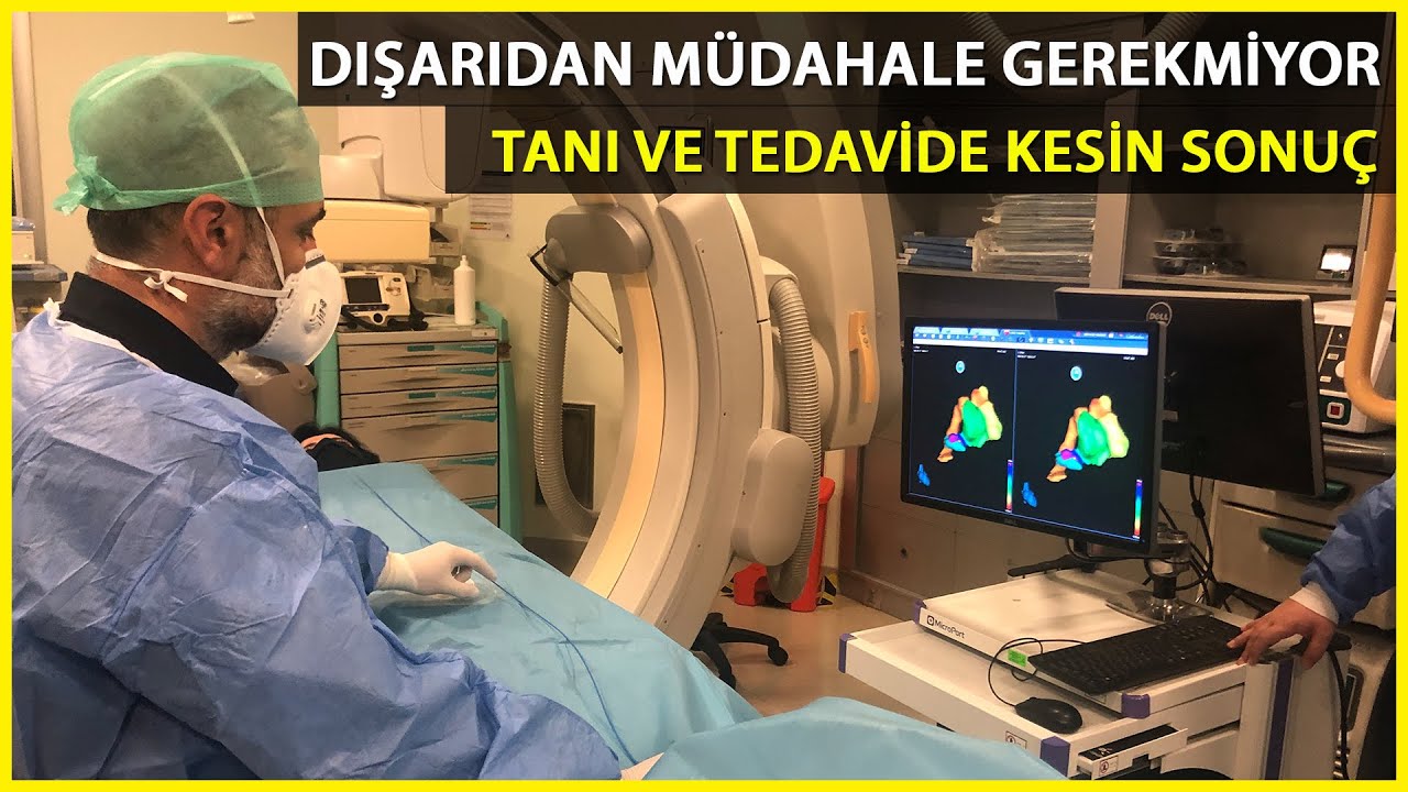 Ritim Bozukluklarının Nedenleri 3 Boyutlu Görüntülenebiliyor