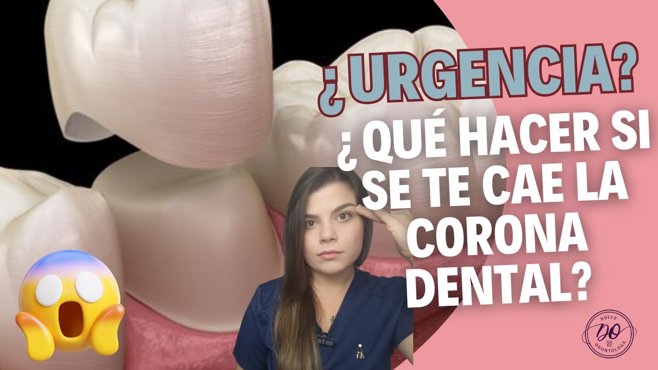 Qué hacer si se te cae una CORONA DENTAL en 2023 🦷😱⚡