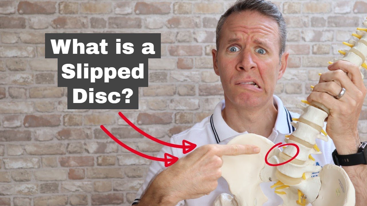 What Is A Slipped Disc? - A Spinal Specialist Physio Explains