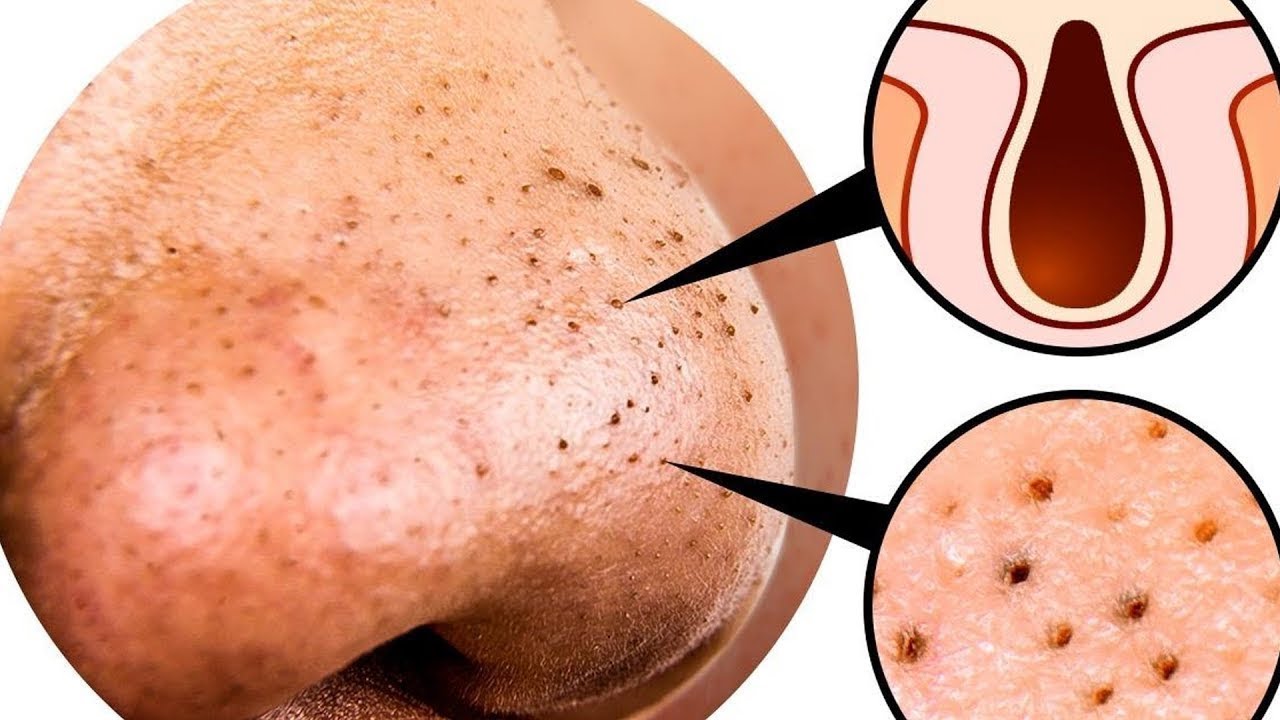 24 TRUQUES DE CUIDADOS COM A PELE QUE VOCÊ PRECISA CONHECER