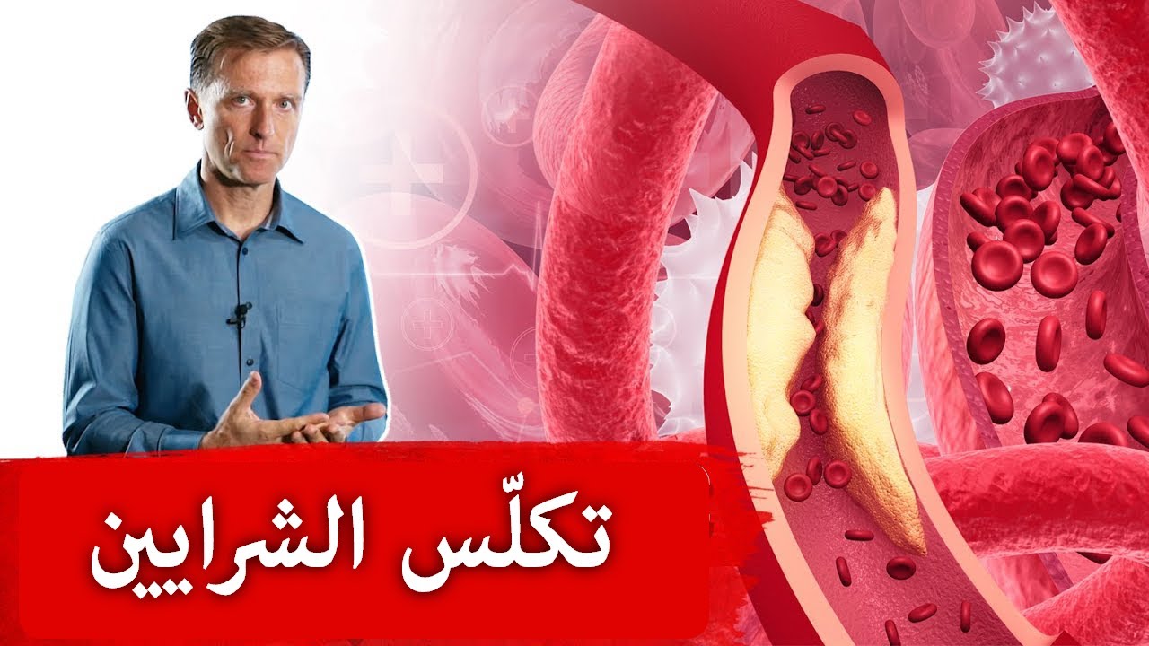 التخلّص من تكلّس الشرايين