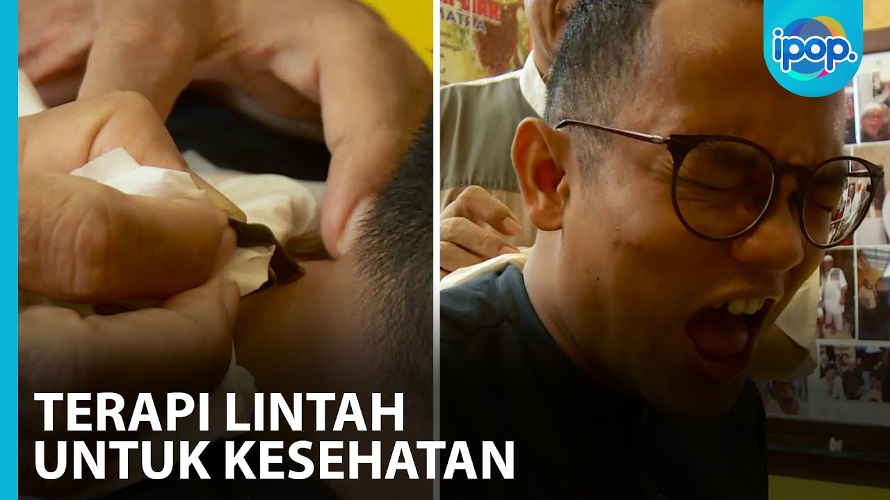 Ini Bund Terapi Lintah Yang Bikin Peredaran Darah Lancar - IPOP