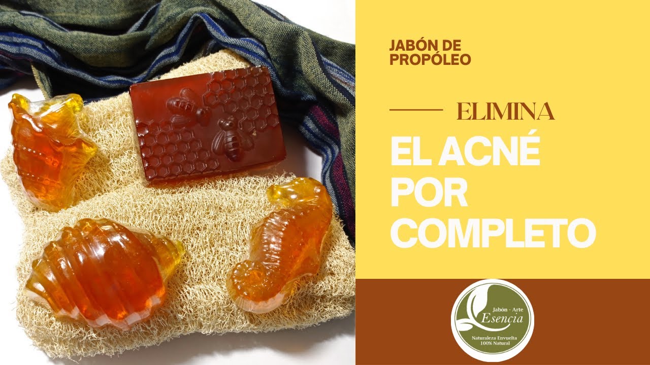 ELIMINA EL ACNÉ CON ESTE JABÓN- ES SÚPER BUENO!!!