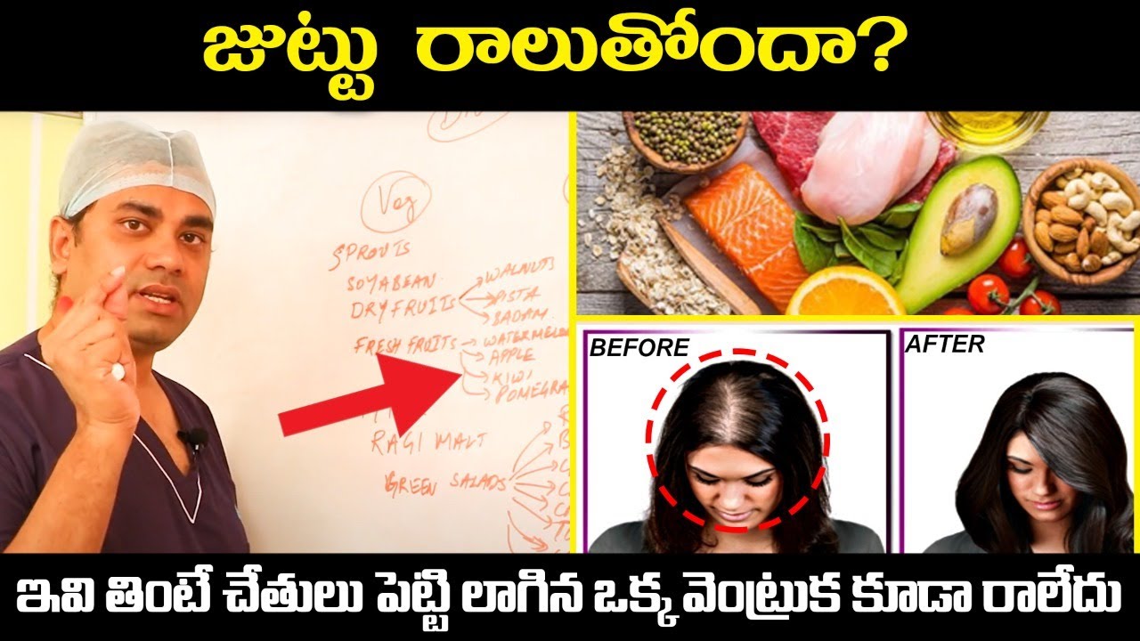 ఇవి తింటే జుట్టు రాలదు || Diet For Hair Fall Control In Telugu || Celestee Skin And Hair Clinic
