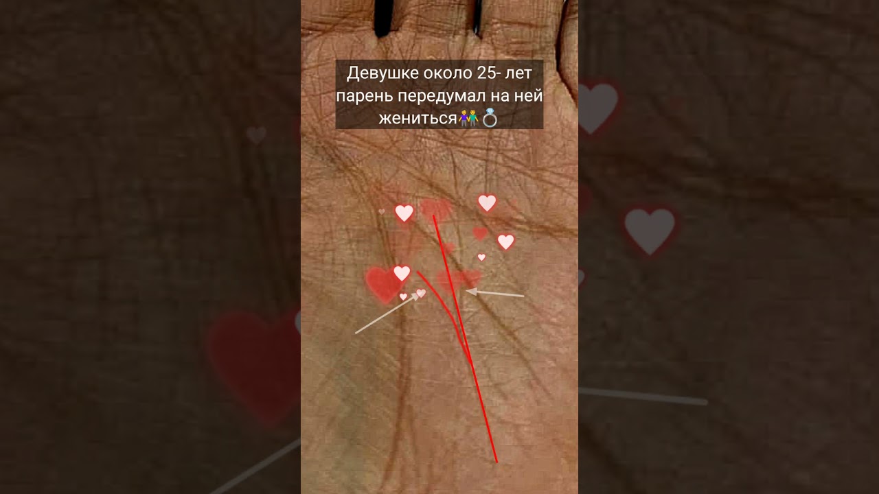 Свадьбы не будет❌#хирология
