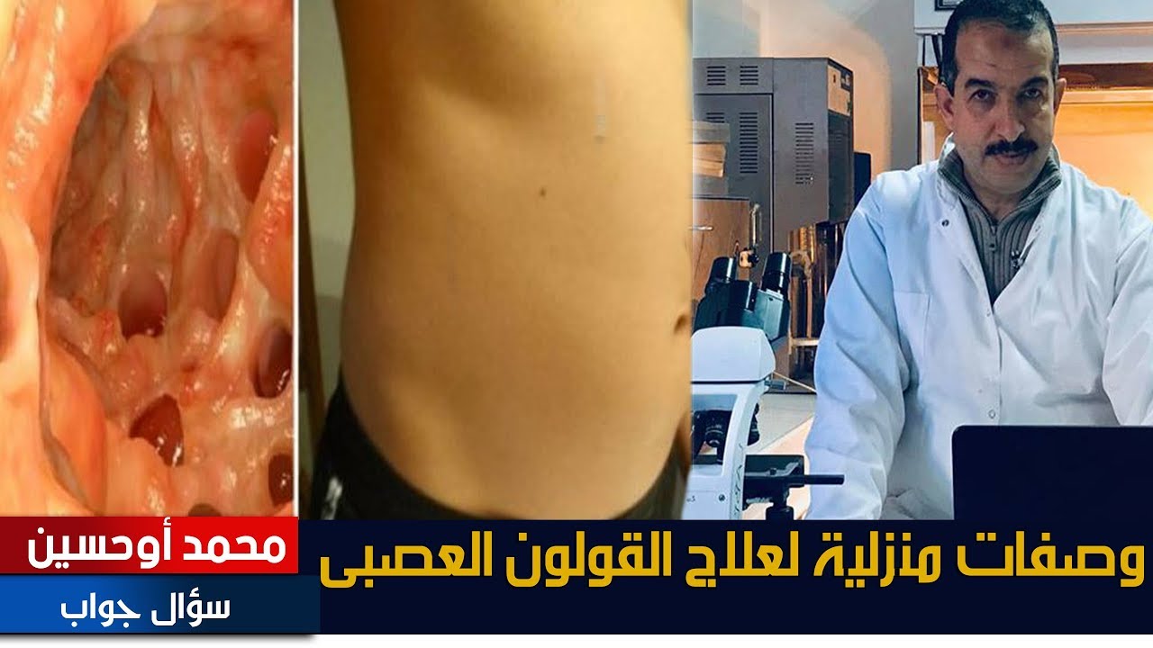 وصفات منزلية لعلاج القولون العصبى - أو مايسمى ب /بومزوي*