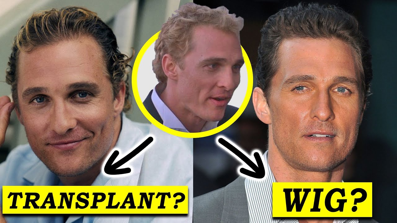 The Truth about Matthew McConaughey Hair Loss Reversal!