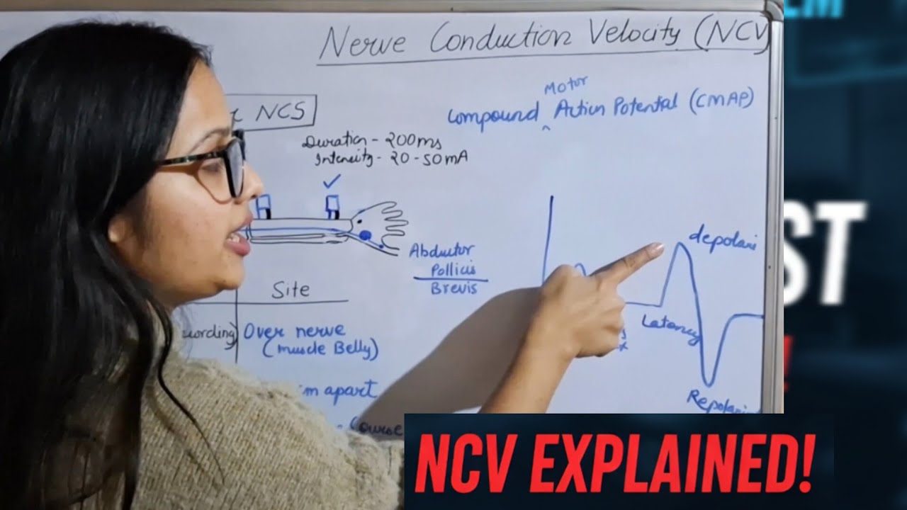 ( NCV )Nerve Conduction Velocity Test Explained || Motor & Sensory Nerve #physiotherapy