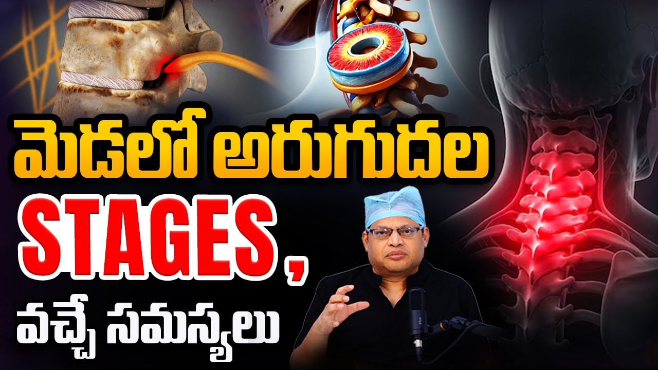 మెడ నొప్పి రావడానికి కారణం ఏమిటి? | Cervical spondylosis treatment | Neck pain | Dr GPV Subbaiah