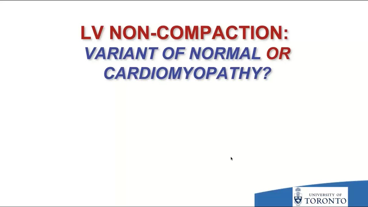 LV Non-Compaction: Variant of normal or cardiomyopathy?