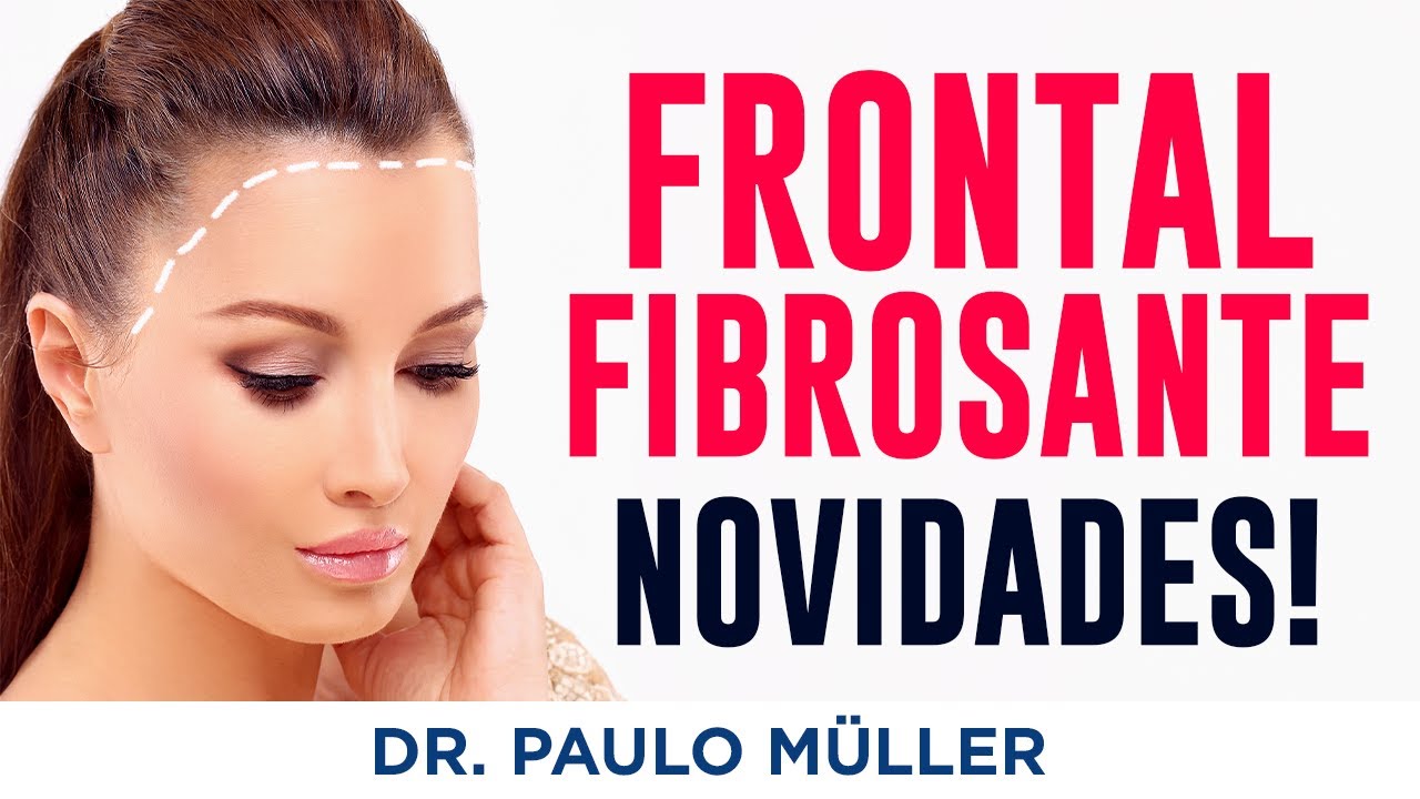 Novidades no Tratamento da Alopecia Frontal Fibrosante!