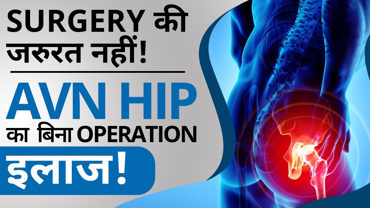 Surgery की जरूरत नहीं AVN HIP का बिना ऑपरेशन इलाज #AVNtreatment #HIPrecovery  #bonehealth