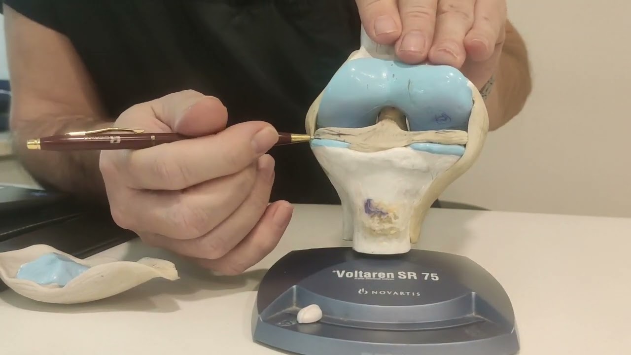 Bu Videoyu Seyretmeden Menisküs Ameliyatı Olmayın.