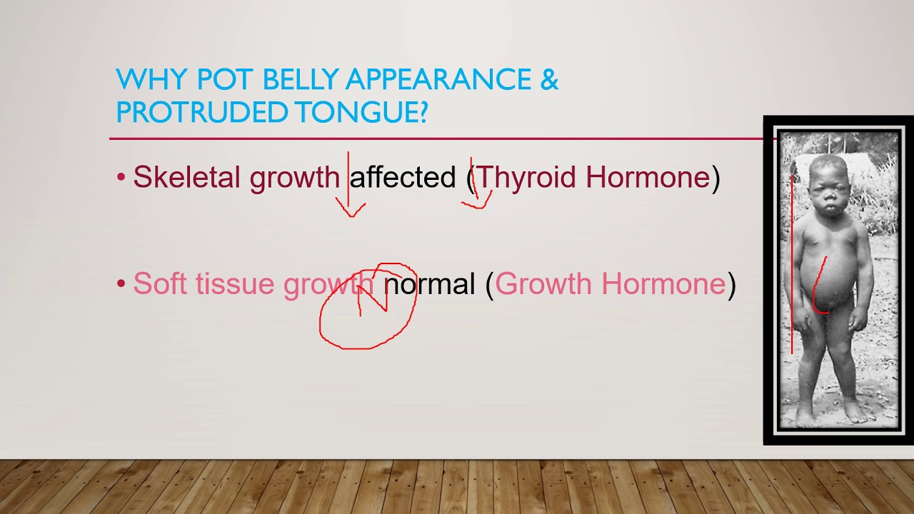 Why is 'Pot Belly Appearance' and 'Protruded Tongue' seen in Cretinism?
