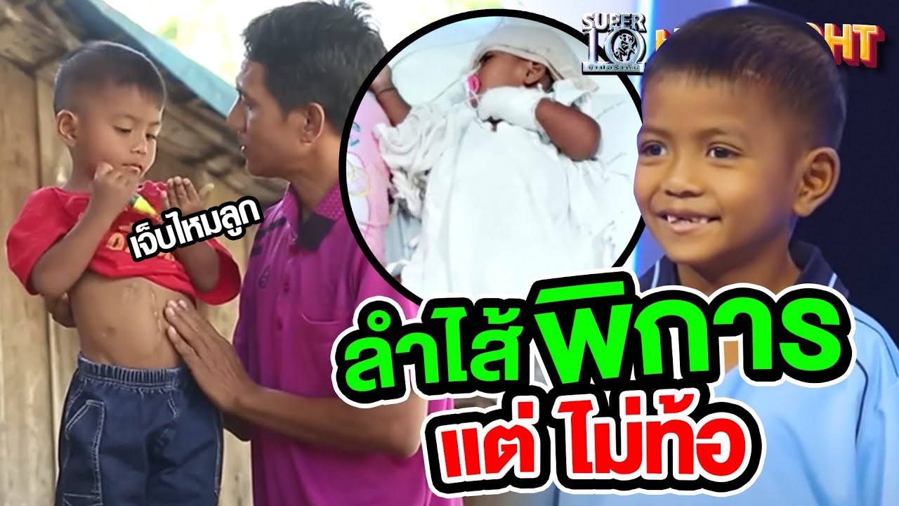 เด็กคนนี้ #ลำไส้พิการ แต่ไม่ท้อ HIGHLIGHT | SUPER10