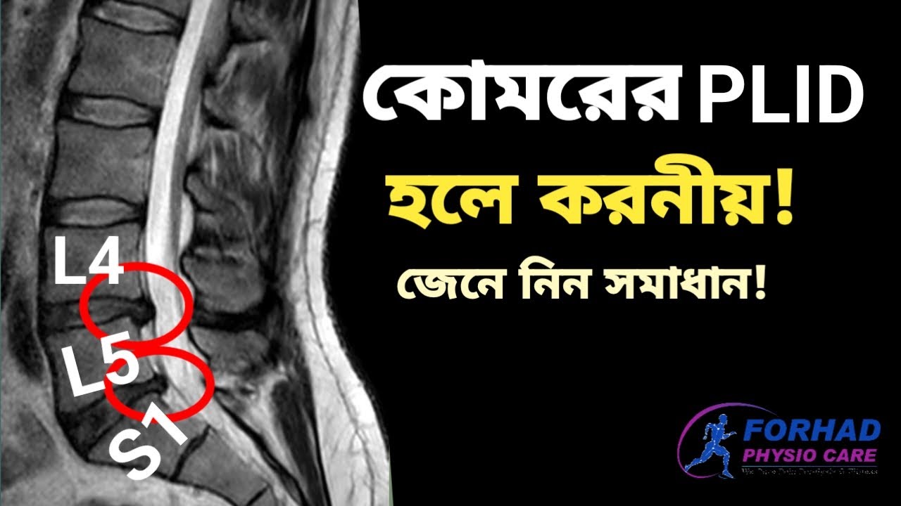 কোমরে PLID বা ডিস্ক সরে গেলে করনীয় | L4,L5,S1 ডিস্ক সরে গেলে সমাধান জেনে নিন | Slip Disc / Back pain