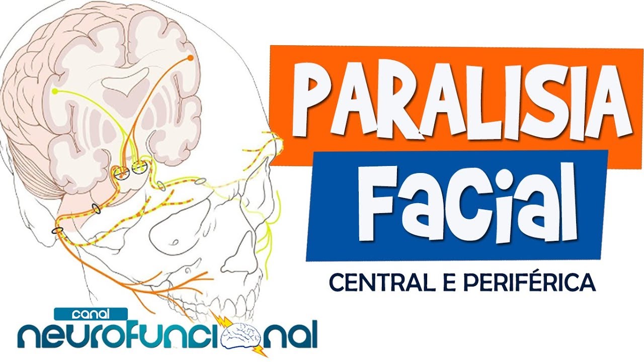 PARALISIA FACIAL (Aula completa) - Rog&eacute;rio Souza