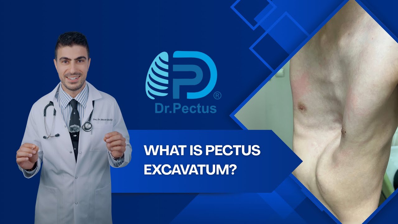 Everyone with pectus excavatum deformity should watch it!