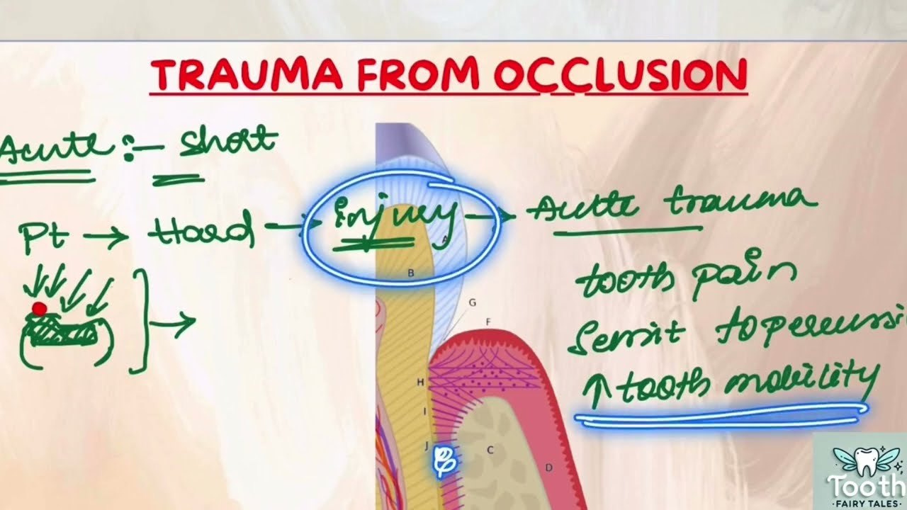 Trauma from occlusion(TFO) Periodontics lectures part 1