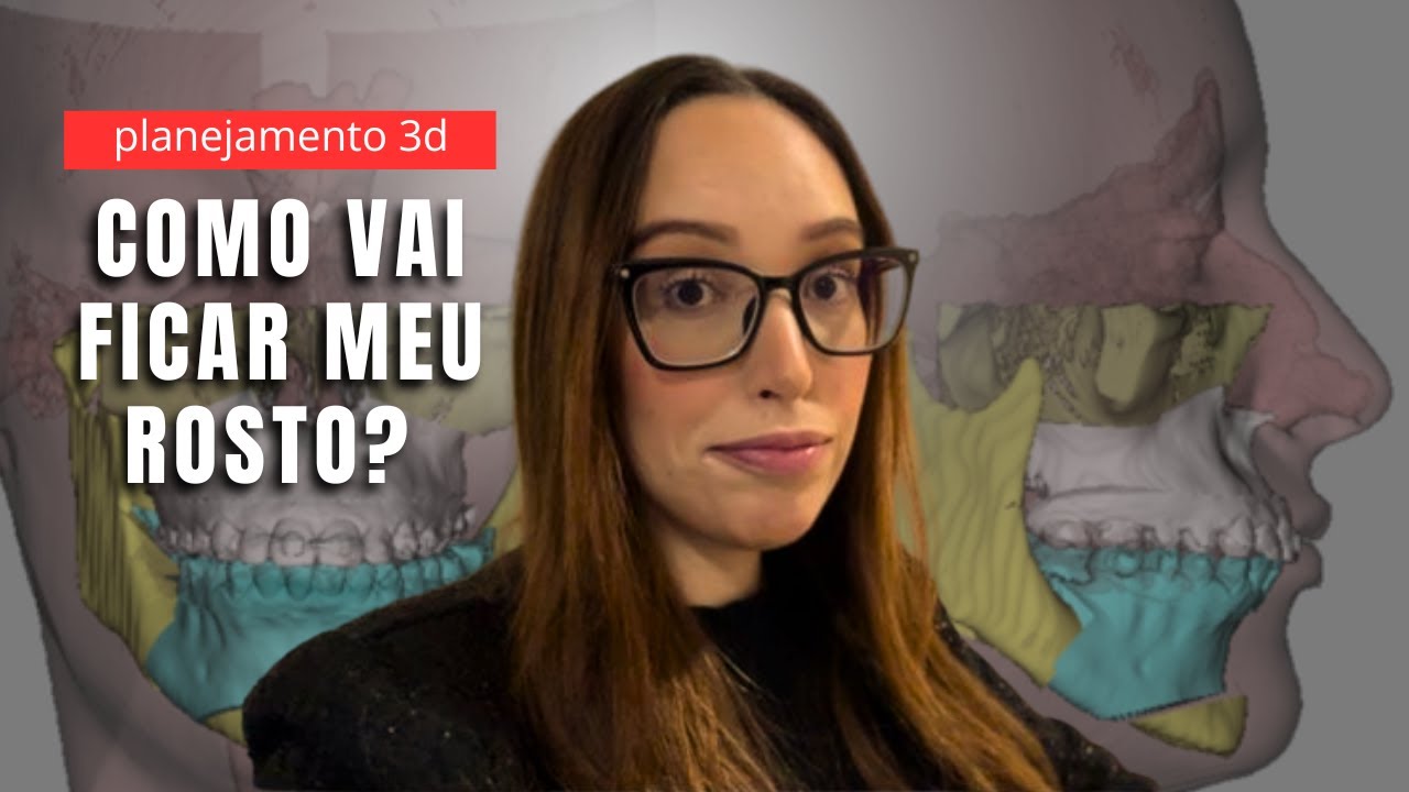 Exames para cirurgia ortognática e planejamento 3d