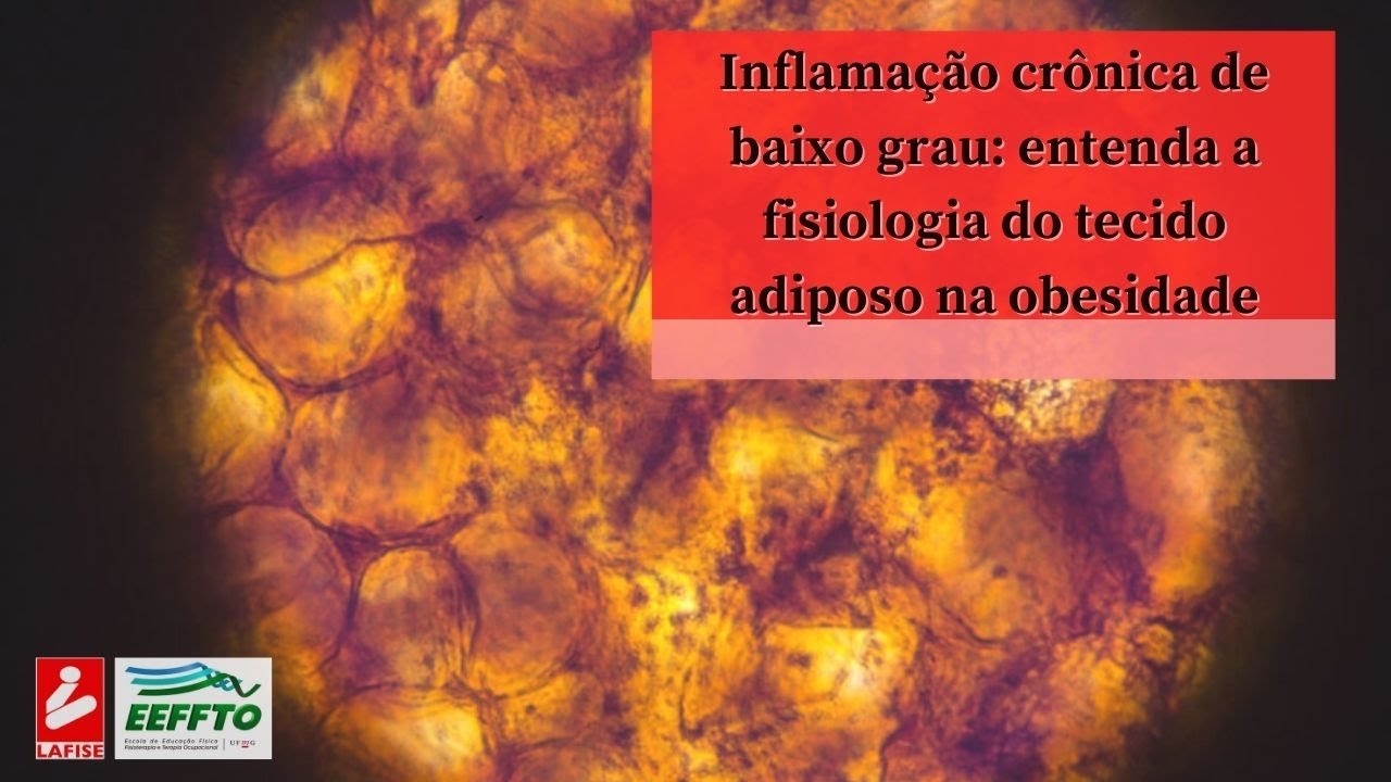 Vídeo 27 – Inflamação crônica de baixo grau: entenda a fisiologia do tecido adiposo na obesidade