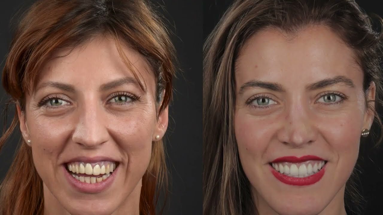 What patients say - Dentcof